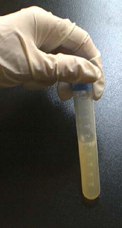 tubo de ensaio de esperma